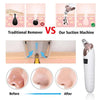 Blackhead Remover Vacuum – Deep Pore Cleaner with 4 Suction Heads