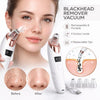 Blackhead Remover Vacuum – Deep Pore Cleaner with 4 Suction Heads