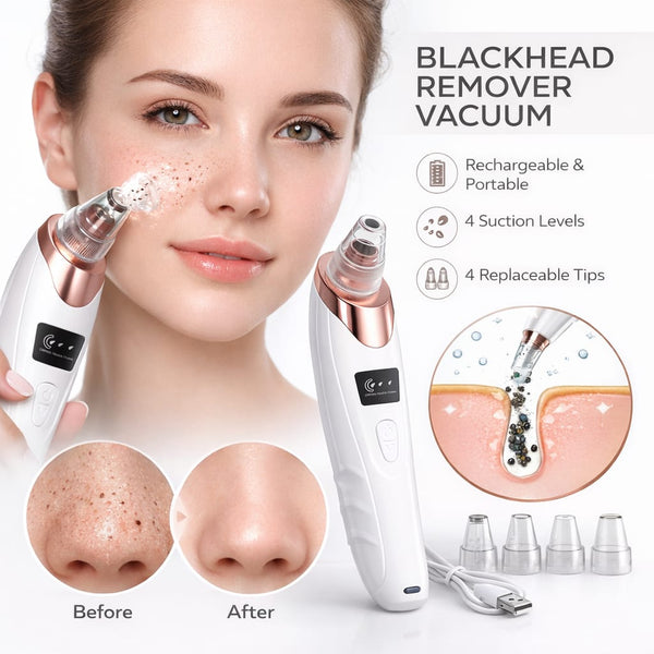 Blackhead Remover Vacuum – Deep Pore Cleaner with 4 Suction Heads